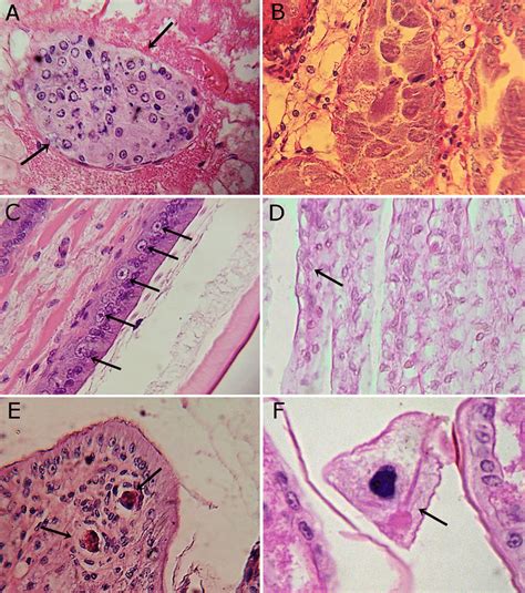 Cortes Histol Gicos De Penaeus Vannamei Con Lesiones Producidas Por