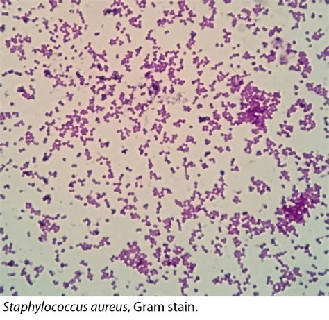 Gram Positives Staphylococcus Streptococcus Clostridium Etc Microtosis