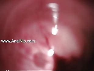 Deep Anal Sex With Hairy Chinese Babe