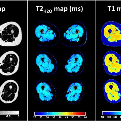 Representative Fat Fraction Ff Water T2 T2 H2o And T1 Parametric