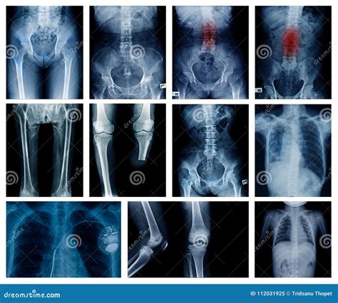 X Ray Collection Many Body Part Stock Image Image Of Background