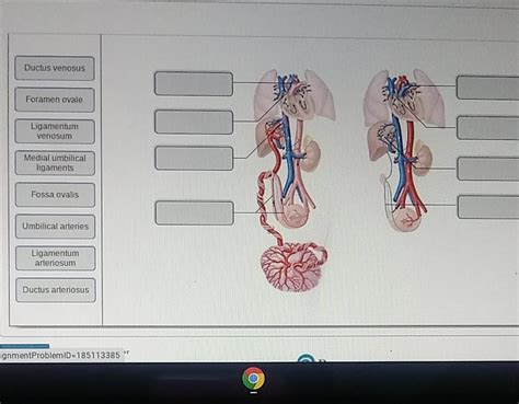 Solved Ductus Venosus Foramen Ovale Ligamentum Venosum I DOO Chegg