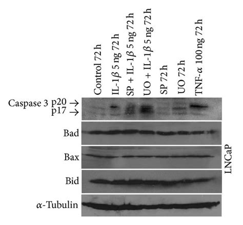 Western Blot Analysis Of Lncap Protein Expression A And B Lncap Download Scientific