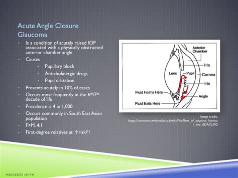 Acute Angle Closure Glaucoma — Learned