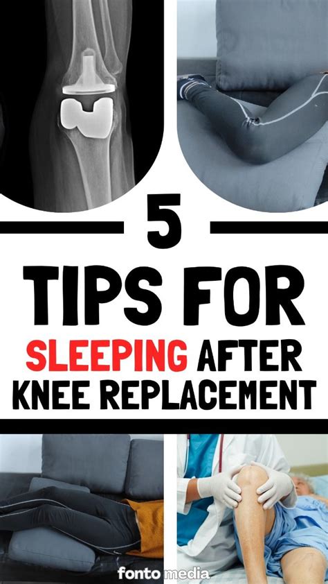 My Best Tips For Better Sleeping After Knee Replacement En 2024