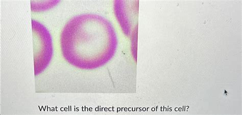 Solved What cell is the direct precursor of this cell? | Chegg.com