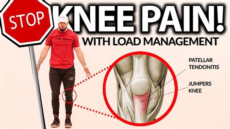 Load Management How To Fix Patellar Tendonitis And Jumpers Knee Youtube