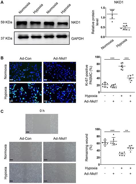 Naked cuticle homolog prevents mouse pulmonary arterial hypertension via inhibition of Wnt β