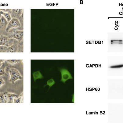 Intracellular Distribution Of EGFP Fused HSETDB1 Protein In HeLa Cells