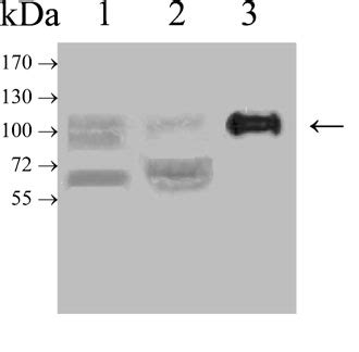 Figure 1 From Comparison Of The Substrate Specificities And Catalytic