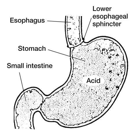 esophageal sphincter  cardiac sphincter
