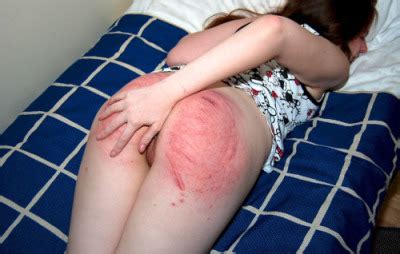 Very Well Spanked Ass Tumbex