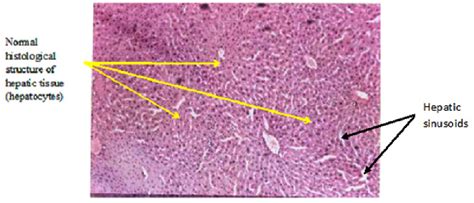 Liver Sinusoids Histology