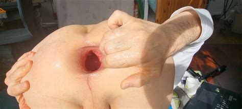 Giantaasholes Mega Hole Fist And Fucked Nude Pics Xhamster