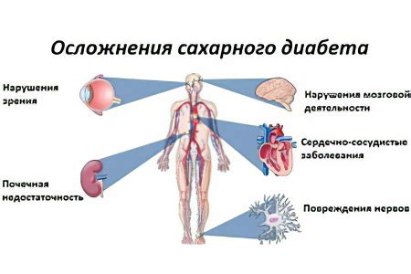Эффективные таблетки при сахарном диабете 2 типа
