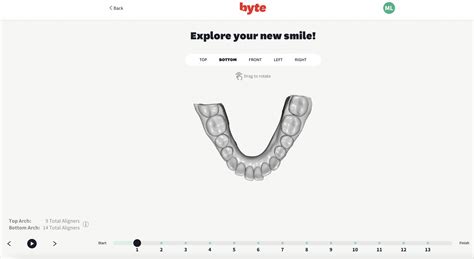 Byte Teeth Aligner Trial Before And After Review Just Simply Mom