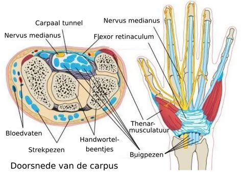 Ultraselectieve Endoscopische Carpale Tunnelchirurgie