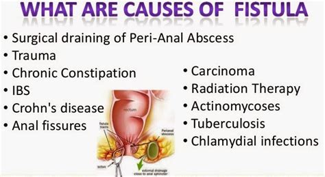 Eeshanayurveda: Ayurveda treatment for fistula in ano