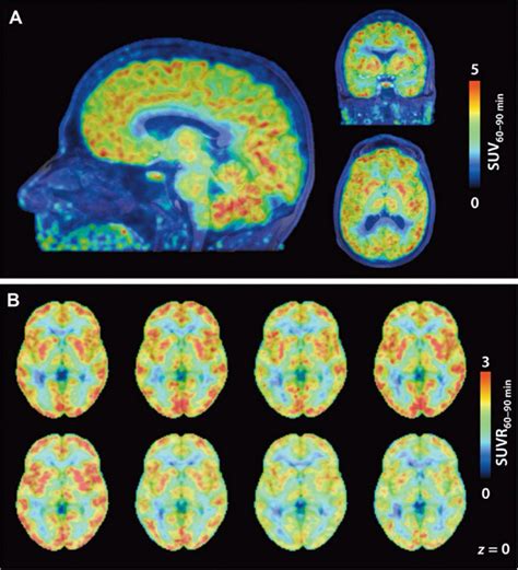 A New Type Of Brain Scan Shows Where Genes Are Being Turned Off | Popular Science | Scoopnest