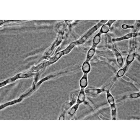 Моноблефаридомицеты (Monoblepharidomycetes) | LifeCatalog