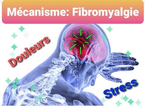 M Canisme De La Fibromyalgie Sant M Decine