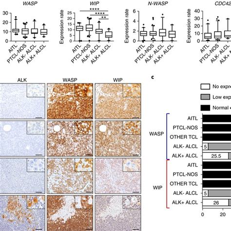 Wasp And Wip Are Selectively Down Regulated In Alcl A Gene Expression Download Scientific