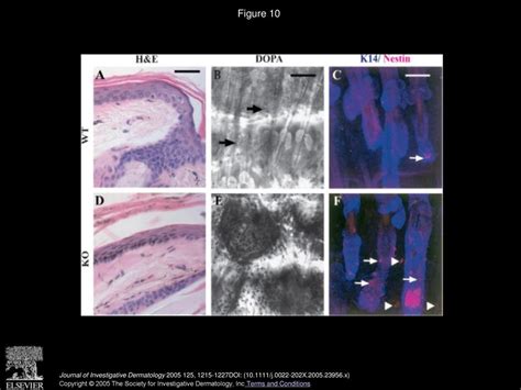 Different Consequences of β1 Integrin Deletion in Neonatal and Adult