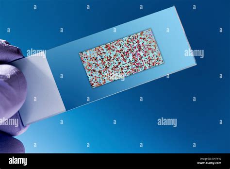 Biochip hi-res stock photography and images - Alamy