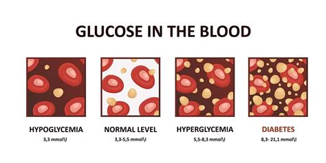 High Blood Sugar Symptoms 8 Signs And Symptoms Of Hyperglycemia