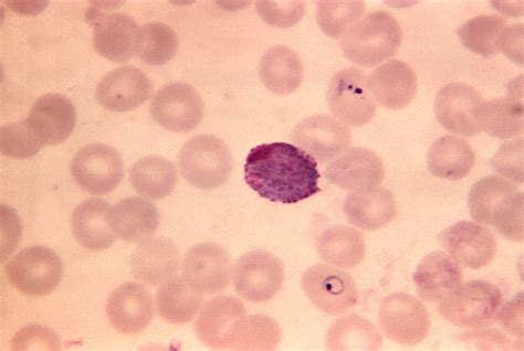 Free picture: blood smear, photomicrograph, plasmodium vivax, macrogametocyte, mag, 1250x