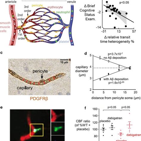 Schematic Diagram Showing How The Amyloid Beta And Tau Cascades Can Be