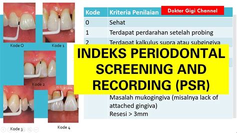 Indeks Periodontal Screening And Recording Psr Dokter Gigi