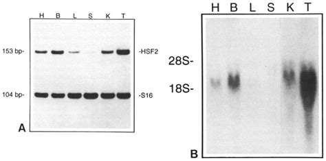 Analysis Of HSF2 MRNA In Mouse Tissues A Total RNA Extracted From