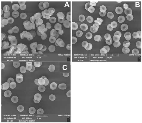 Scanning Electron Microscopy Of Reticulocytes And Rbcs A Immature