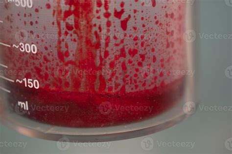 Blood Loss In Container In Operating Room 11694512 Stock Photo At Vecteezy