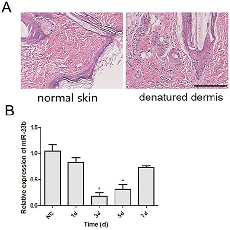 Histological Examination Of Denatured Dermis And The Expression Of