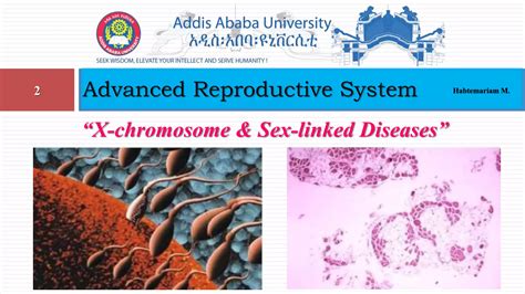 X Chromosome And Sex Linked Diseases Pptx Blood Disorders Diseases And Conditions