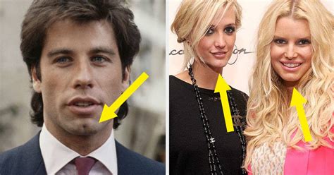 49 Famous People With Butt Chins