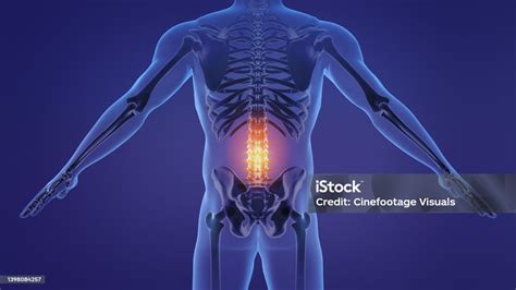 animasi tulang belakang lumbar  menyakitkan foto stok