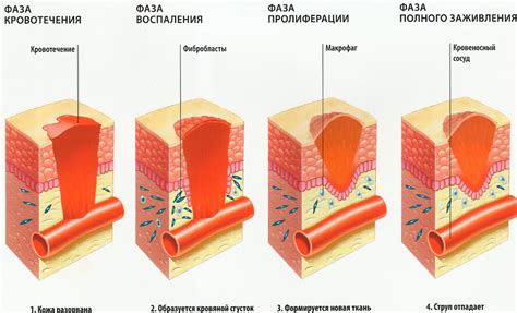 Лечение открытых ран – принципы и этапы