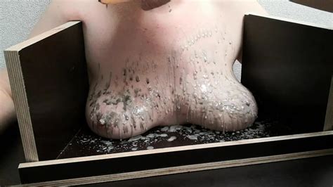 The Tit Torture Device Extrem Hot Candle Wax Part Nude Pics Xhamster
