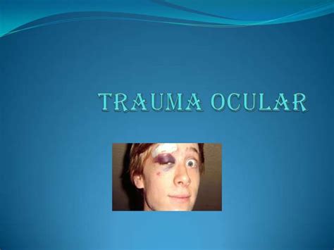 Trauma Ocular Ppt