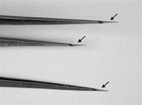 Pantoea Agglomerans As A Cause Of Septic Arthritis After Palm Tree