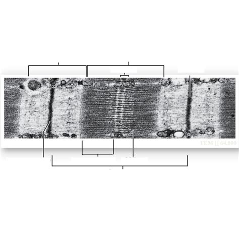 Sarcomere Structure Diagram | Quizlet