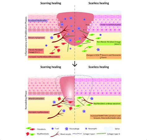 Key Factors Contributing For Scarring And Scarless Wound Healing The