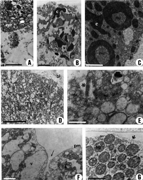 Ac Nuclear Ultrastructure Showing Detail Of The Apoptotic Process In Download Scientific