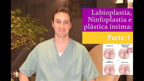 Labioplastia Ninfoplastia E Plastica íntima Parte 1 Youtube