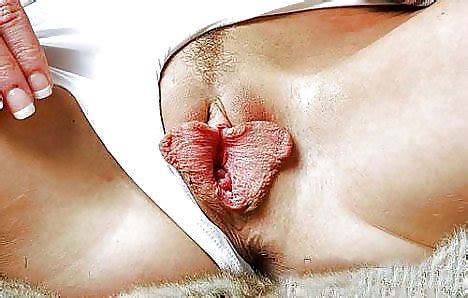 Labia Minora And Majora Porn Pictures XXX Photos Sex Images 937059 PICTOA