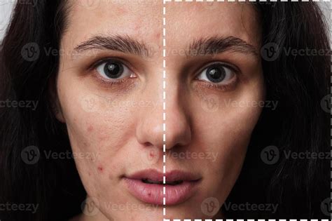 Spot Face Stock Photos Images And Backgrounds For Free Download