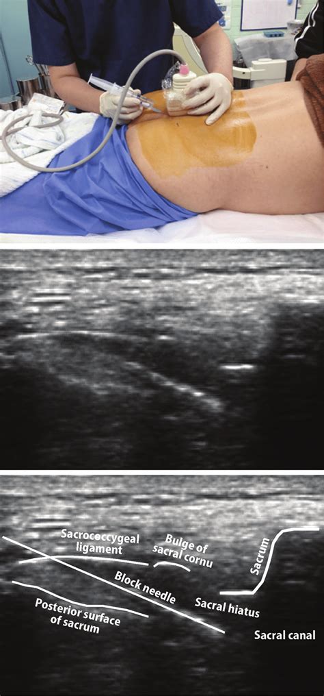ultrasound probe positioning  ultrasound images obtained